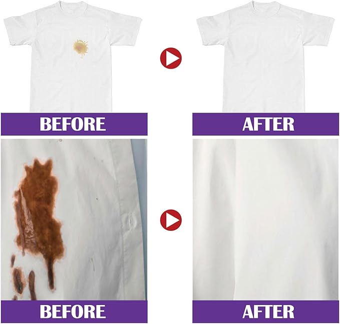 Laundry Stain Remover Enzyme